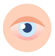 Dry_Eye